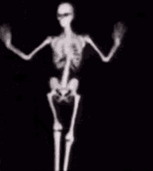 Skeleton Da GIF - Skeleton Da Damn GIFs