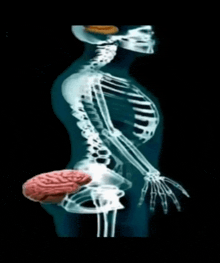 an x-ray of a woman 's skeleton with a brain in her butt