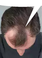 a close up of a man 's head with a speech bubble pointing to it