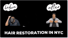 Hair Restoration Nyc GIF - Hair Restoration Nyc GIFs