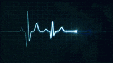 a computer screen shows a heartbeat and a grid of lines