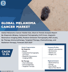 Melanoma Cancer Market GIF - Melanoma Cancer Market GIFs