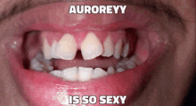 Auroreyy Shire GIF - Auroreyy Shire Shires Teeth GIFs