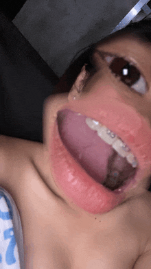 a close up of a woman 's mouth with braces on it