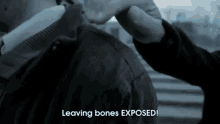 exposed bones