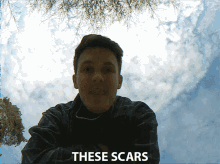 scars marks