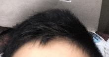 a close up of a person 's forehead with a few hairs showing