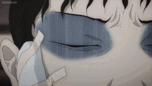 a close up of a person 's face with a bandage on it and the word animegraphe on the bottom right