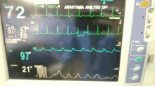 Medicina Monitorizacion GIF - Medicina Monitorizacion Electrocardiograma GIFs