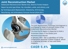 Joint Reconstruction Market GIF - Joint Reconstruction Market GIFs