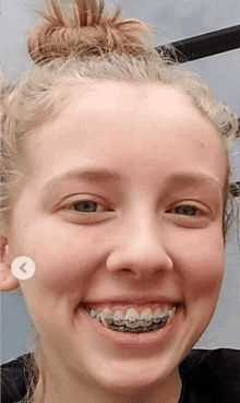 a young woman with braces on her teeth is smiling .