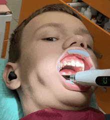 a young boy is getting his teeth examined by a dentist and the digital display shows the time as 10:11