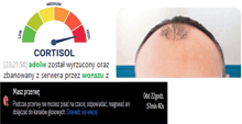 a picture of a man 's head next to a display of cortisol levels