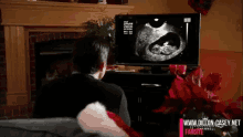 Ultrasound Man GIF - Ultrasound Man Sono GIFs
