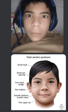 My Honest Reaction To Fetal Alcohol Syndrome GIF - My Honest Reaction To Fetal Alcohol Syndrome GIFs