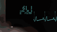 Ekg Machine GIF - Ekg Machine Heart Rate GIFs
