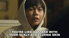 You’re Like A Lizard With Your Scaly-ass Eczema Skin Chris Wang GIF - You’re Like A Lizard With Your Scaly-ass Eczema Skin Chris Wang Dìdi GIFs