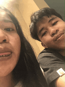 a boy and a girl are posing for a picture and the girl has braces