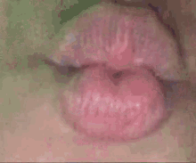 moder labios tongue braces