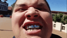 a man with grills on his teeth is making a face .