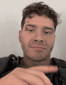 a man with a bruise on his face is smiling