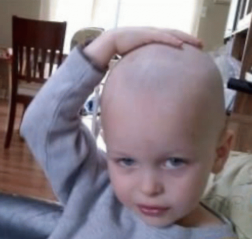 Bald Idiot Bald Gif Bald Idiot Bald Bald Baby Discover Share Gifs