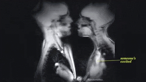 x ray skeleton kiss