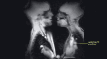 Skeleton Kiss GIF - Skeleton Kiss Xray GIFs