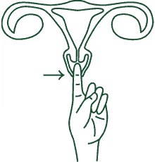 cervix uterus menstrual cup menstruation period nirvana