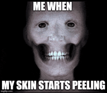 a scary face with the words me when my skin starts peeling below it