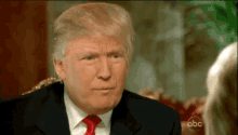 Trump Hairline GIF
