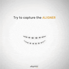 Alignme Find Aligners GIF - Alignme Find Aligners Aligners GIFs