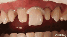 Teeth Dentures GIF - Teeth Dentures Glue GIFs