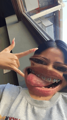 a woman with braces on her teeth is making a face