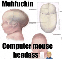 a picture of a baby 's head with the words computer mouse headass