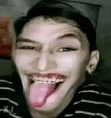 a man with braces on his teeth is sticking his tongue out and smiling .