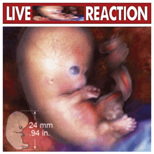 a poster with a picture of an embryo and the words live reaction on it