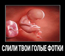 a picture of a baby in the womb with russian text below it