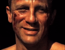 a man with blood on his face is smiling .