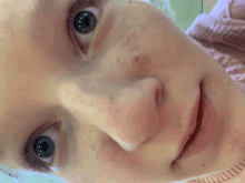a close up of a woman 's face with blue eyes and freckles