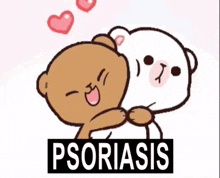 Psoriasis Medical GIF - Psoriasis Medical Medicine GIFs