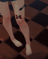 a woman 's legs are shown with a bandage on one leg and a skateboard on the other
