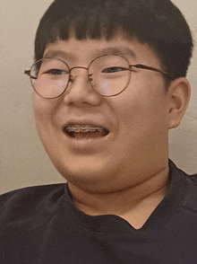 a young boy wearing glasses and braces looks at the camera