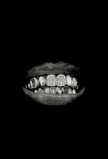 a black and white photo of a person 's teeth with the letters tmrvd written on them
