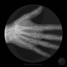 Xray Skeleton GIF - Xray Skeleton Hand GIFs