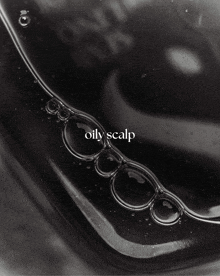 a black and white photo with the words oily scalp on it