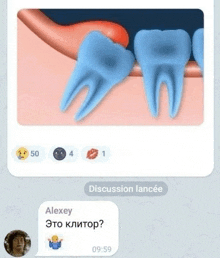 a conversation between alexey and discussion lancee with a picture of teeth