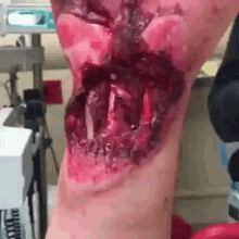 a close up of a wound on a person 's leg