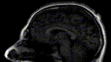 roccos brain brainwasher brain skull rocco