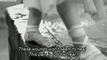 Real Wounds GIF - Real Wounds GIFs